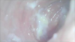 Vaginalexploration Cam Inside